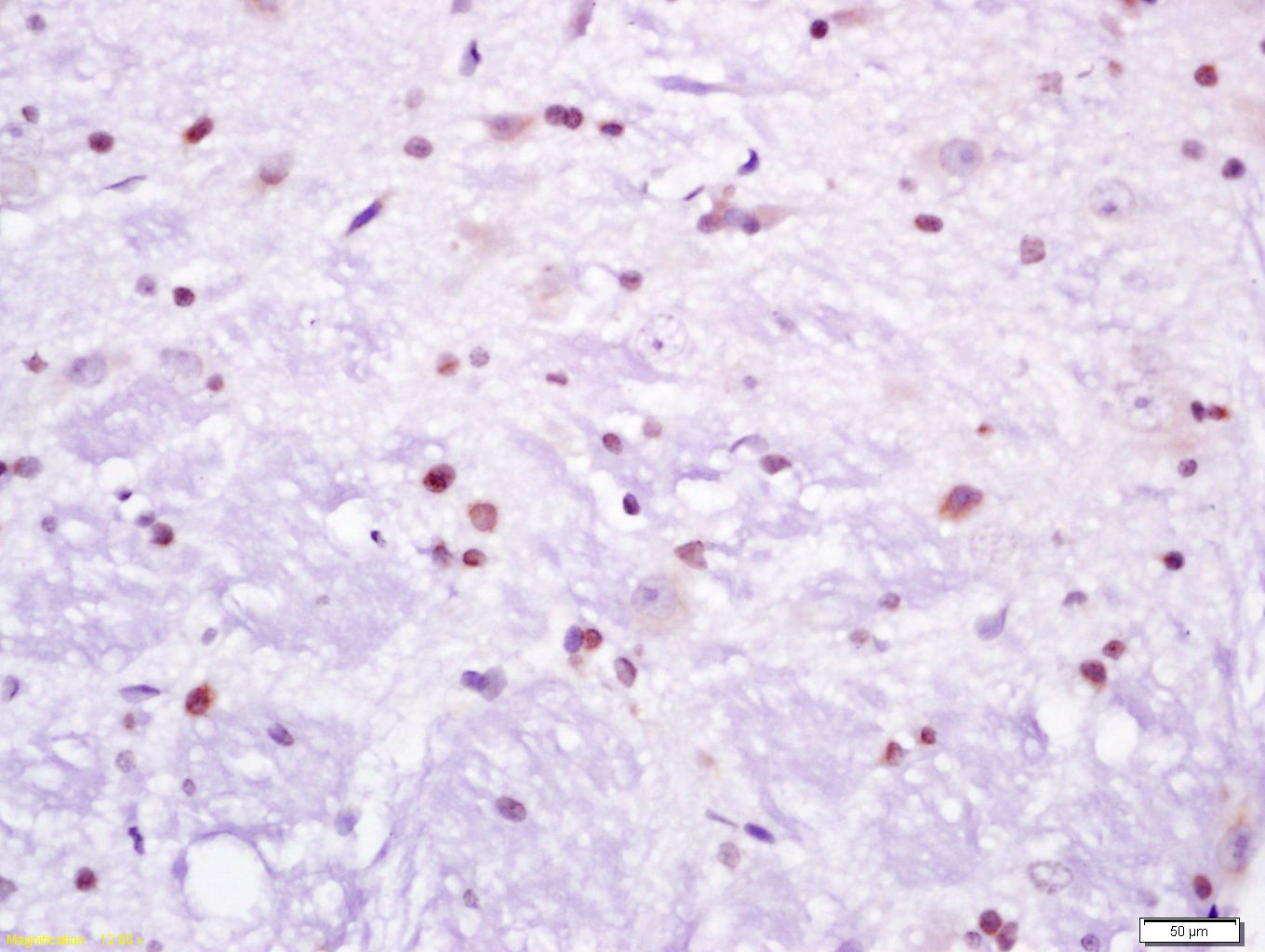 转录因子3抗体-bs-6065R