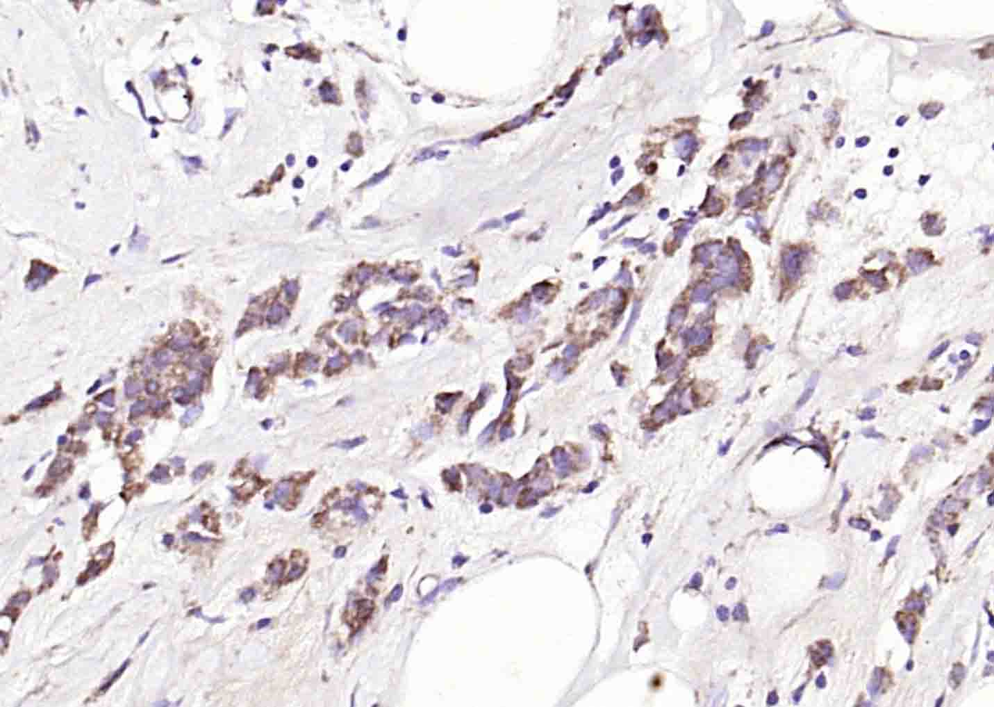 花生四烯酸15脂氧合酶2抗体-bs-6335R