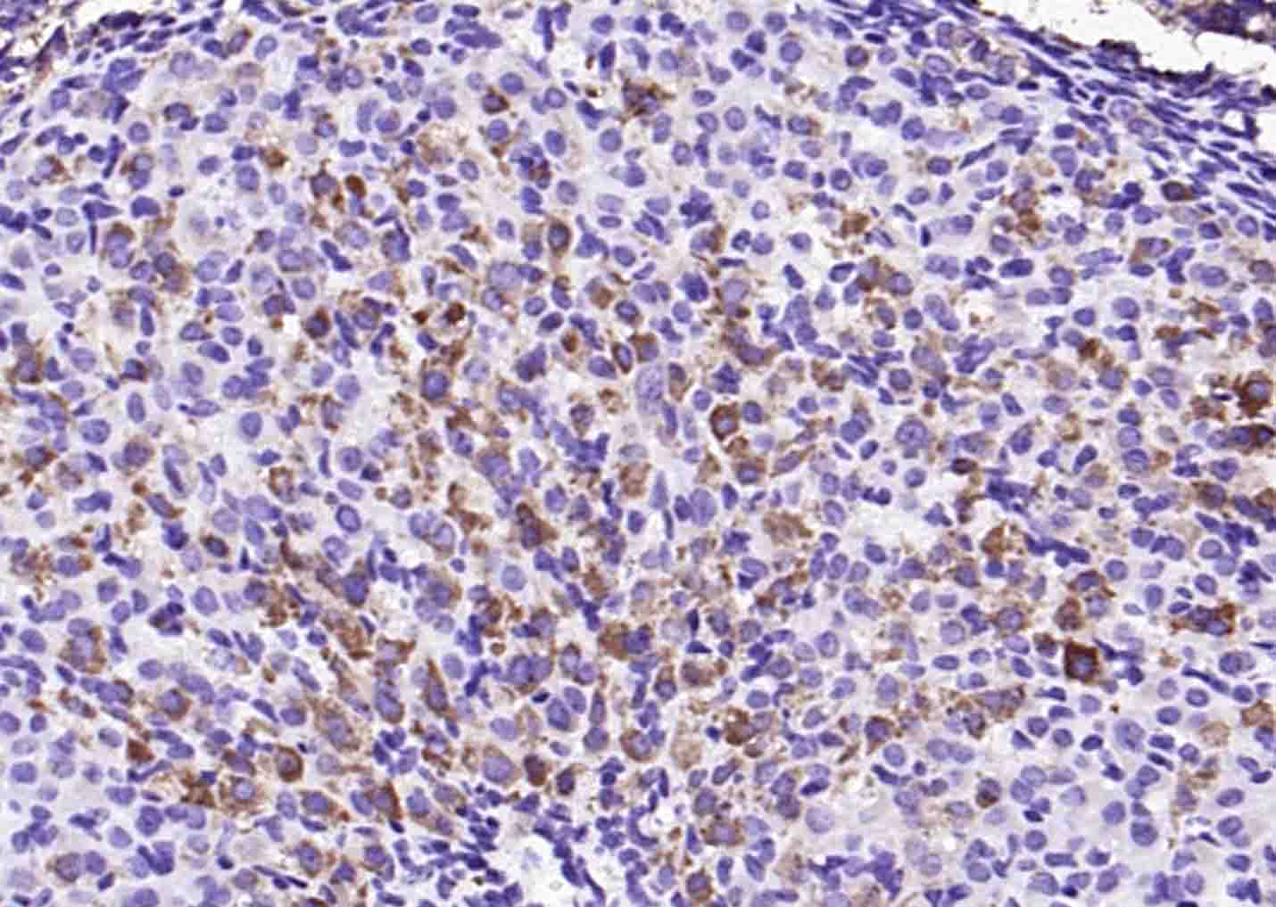 花生四烯酸15脂氧合酶2抗体-bs-6335R