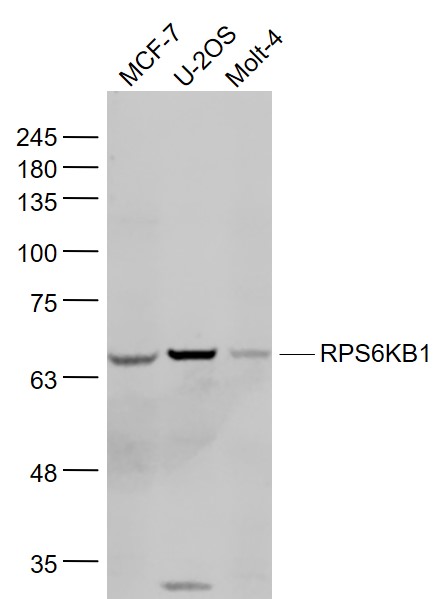 RPS6KB1 Rabbit pAb (一抗) | Bioss