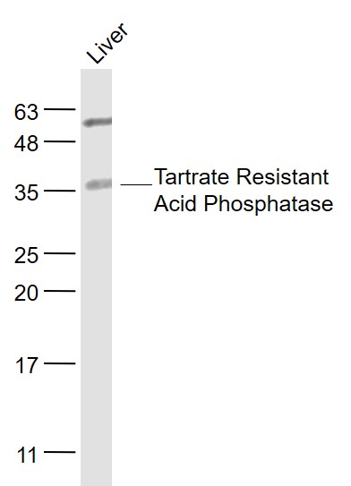 抗酒石酸酸性磷酸酶5型/5型酸性磷酸酶抗体-bs-6434R