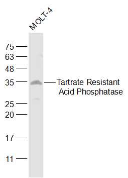 ACP5 Rabbit pAb (一抗) | Bioss