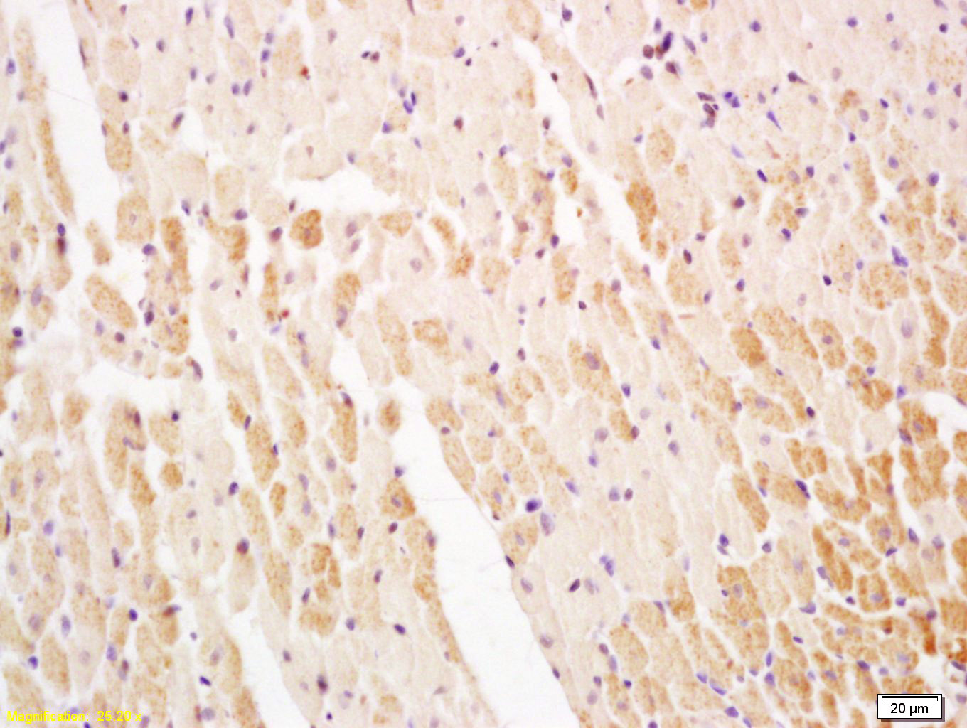 Serca2/SERCA2 ATPase Rabbit pAb (一抗) | Bioss