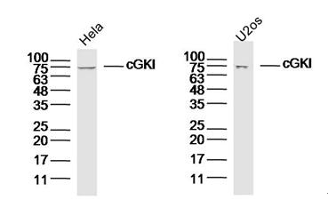 cGKI Rabbit pAb (一抗) - WB,ICC/IF | Bioss