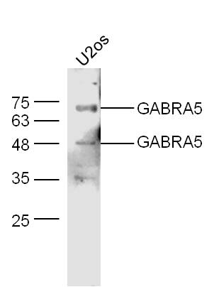 GABRA5 Rabbit pAb (一抗) | Bioss