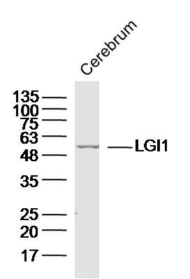LGI1 Rabbit pAb (一抗) | Bioss