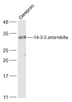 14-3-3 protein ζ/δ抗体-bs-6790R