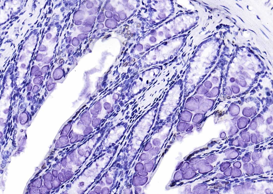 细胞死亡活化蛋白抗体-bs-6796R