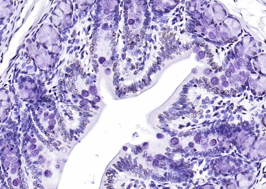 细胞死亡活化蛋白抗体-bs-6796R