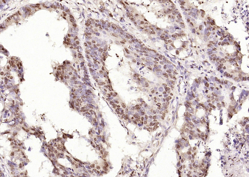 细胞死亡活化蛋白抗体-bs-6796R