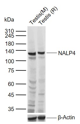 NALP4 Rabbit pAb (一抗) | Bioss
