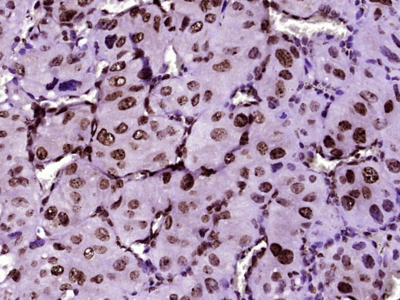 生肌决定因子Myf5抗体-bs-6936R