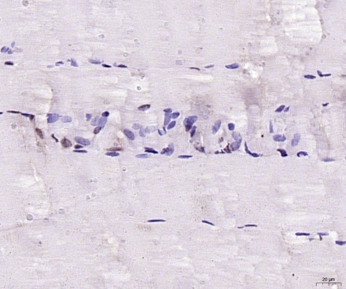 生肌决定因子Myf5抗体-bs-6936R