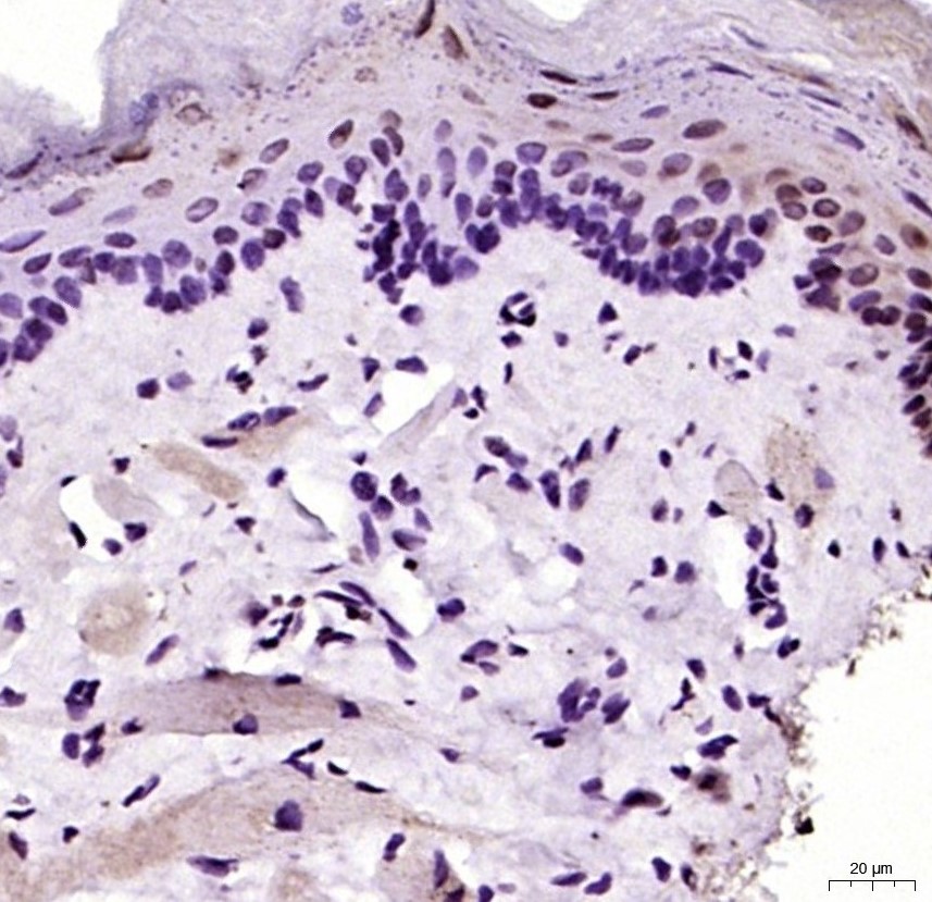 生肌决定因子Myf5抗体-bs-6936R