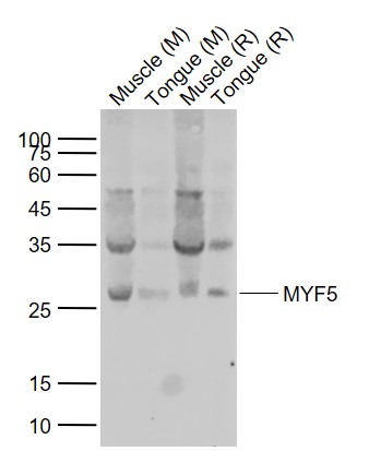 MYF5 Rabbit pAb (一抗) | Bioss