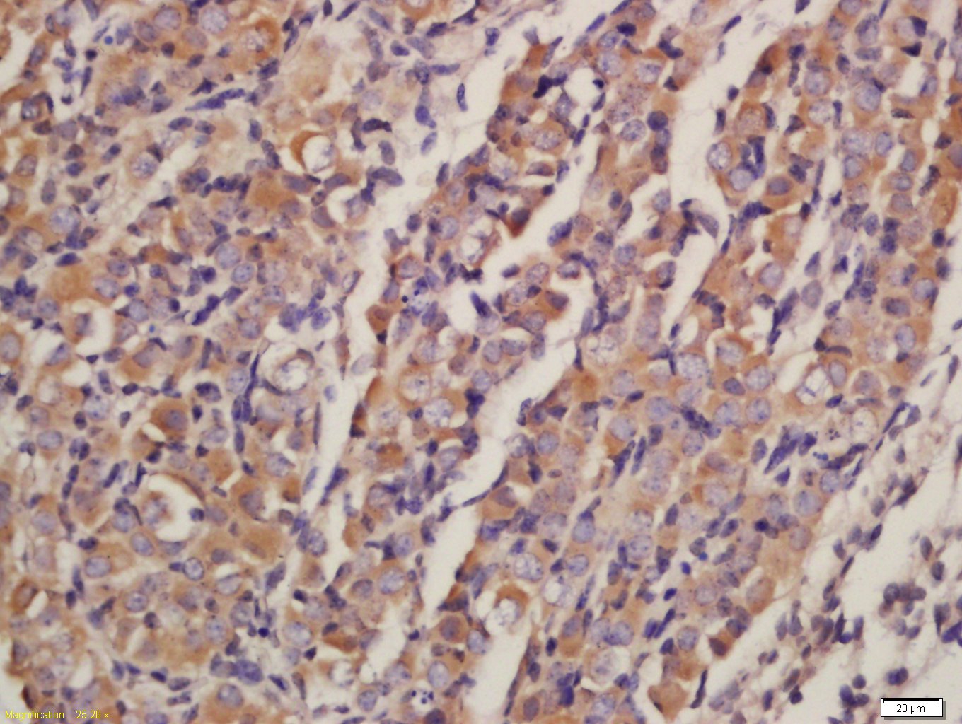 蛋白激酶AKT1,2,3抗体-bs-6951R