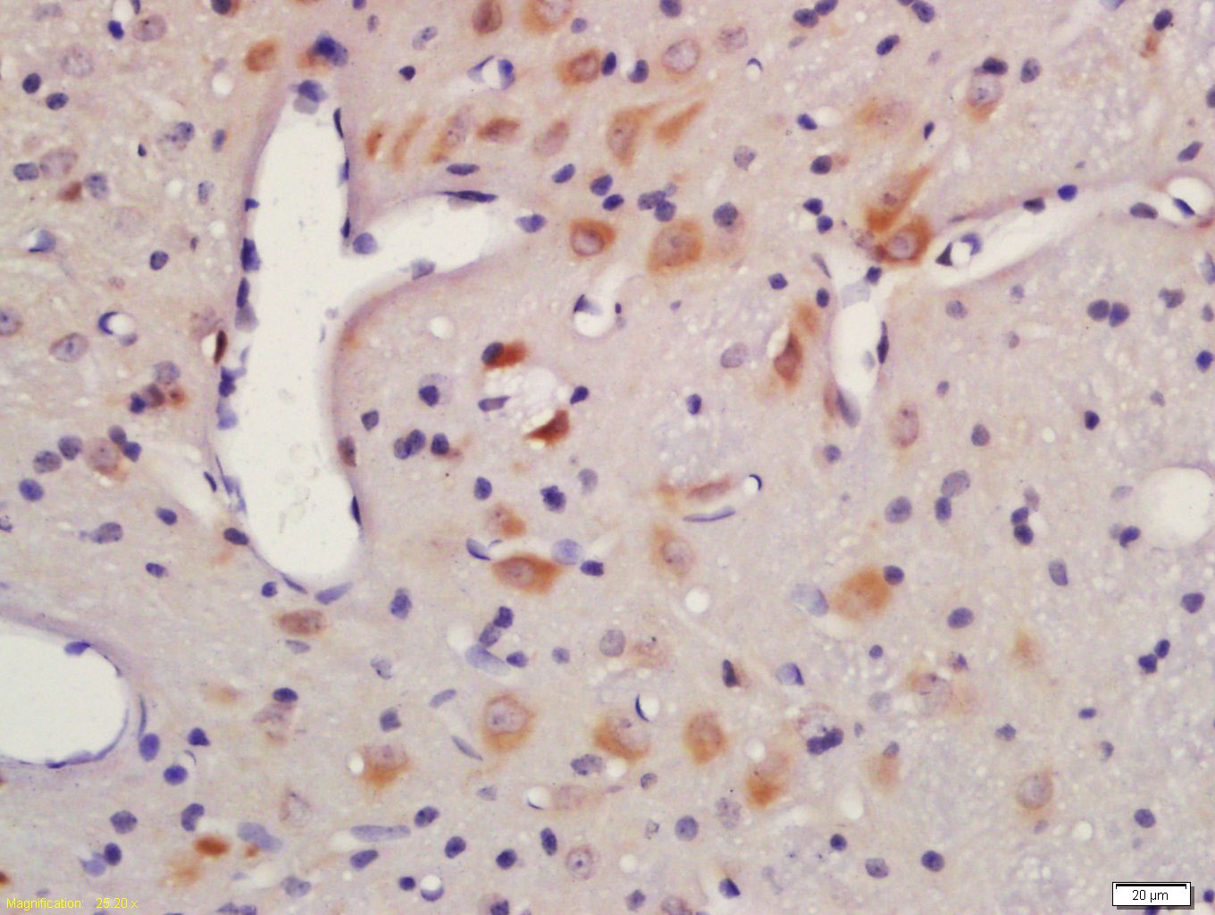 蛋白激酶AKT1,2,3抗体-bs-6951R