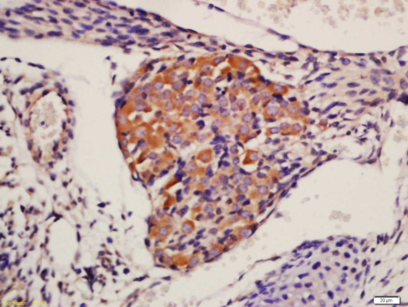 蛋白激酶AKT1,2,3抗体-bs-6951R
