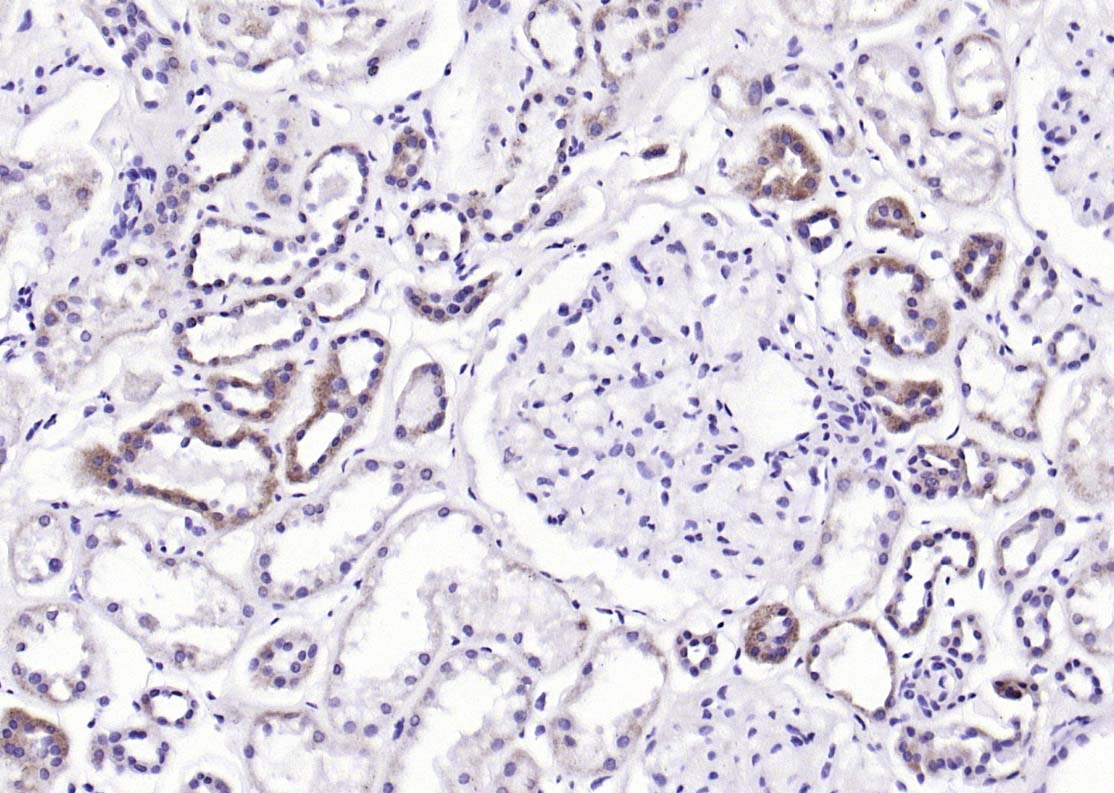 蛋白激酶AKT1,2,3抗体-bs-6951R