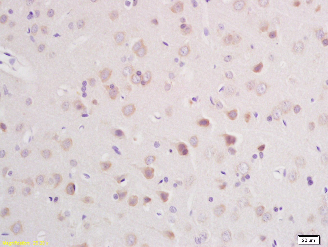 CLCN3 Rabbit pAb (一抗) | Bioss