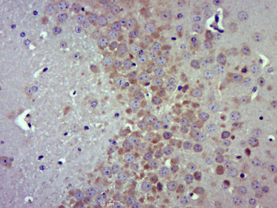 组蛋白精氨酸甲基转移酶5抗体-bs-6992R