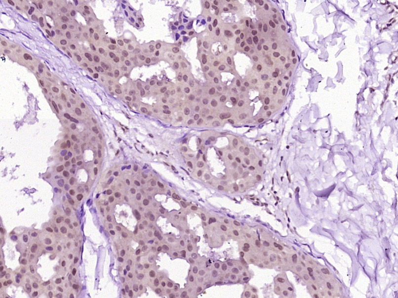 组蛋白精氨酸甲基转移酶5抗体-bs-6992R