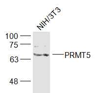 PRMT5 Rabbit pAb (一抗) | Bioss