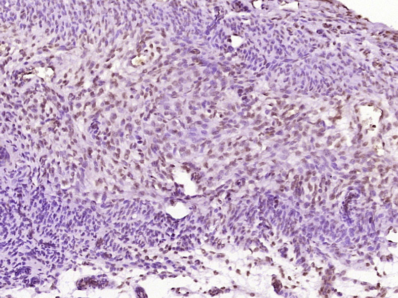 雌激素受体相关蛋白α抗体-bs-6998R