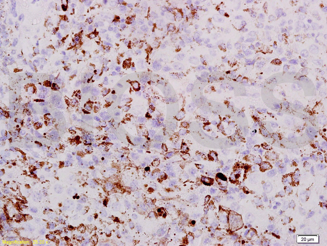 PRAME Rabbit pAb (一抗) | Bioss