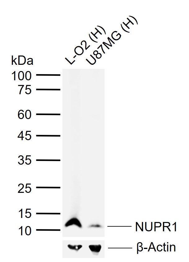 NUPR1 Rabbit pAb (一抗) - WB,IHC-P,IHC-F,IF | Bioss