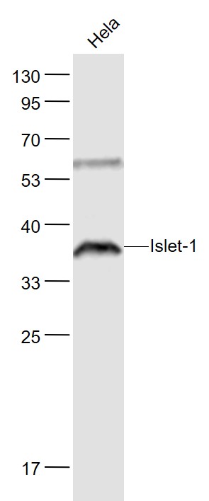 Islet-1 Rabbit pAb (一抗) | Bioss