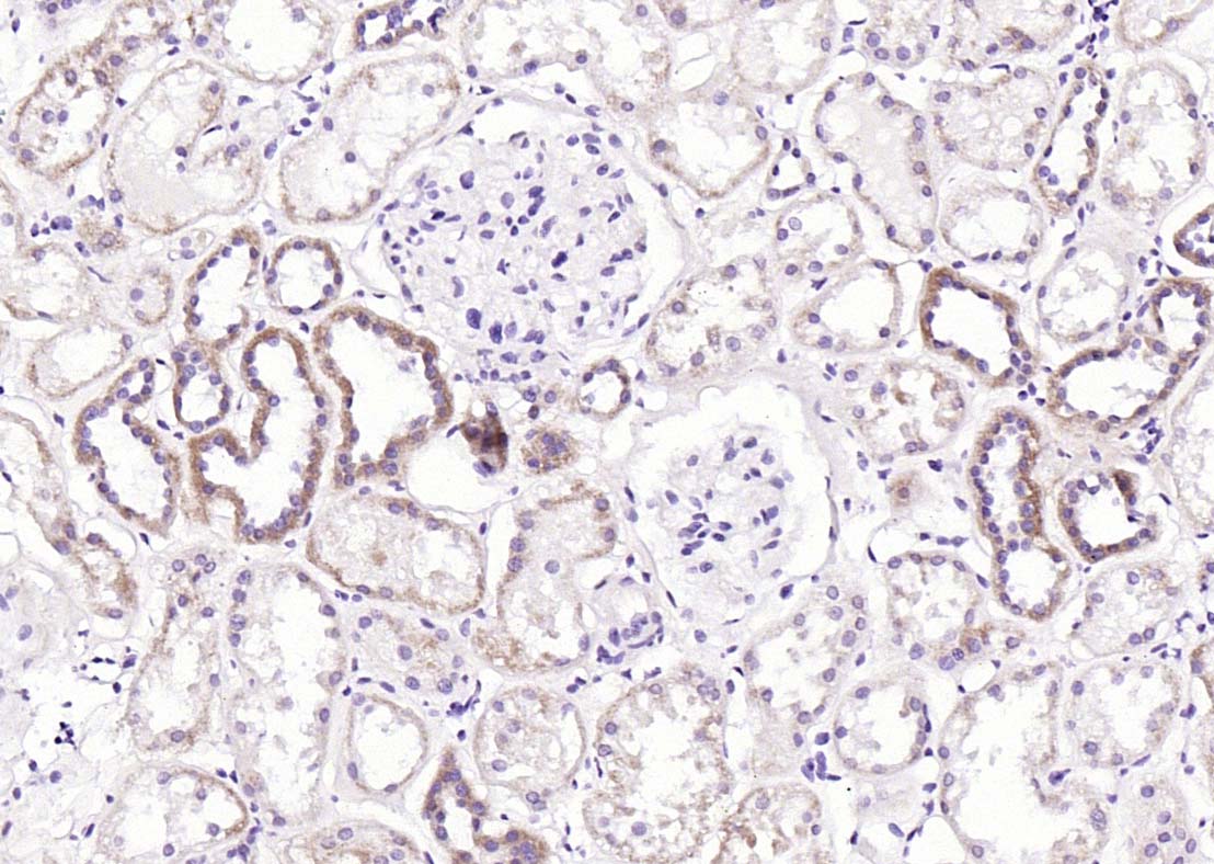 自噬相关蛋白14抗体-bs-7462R