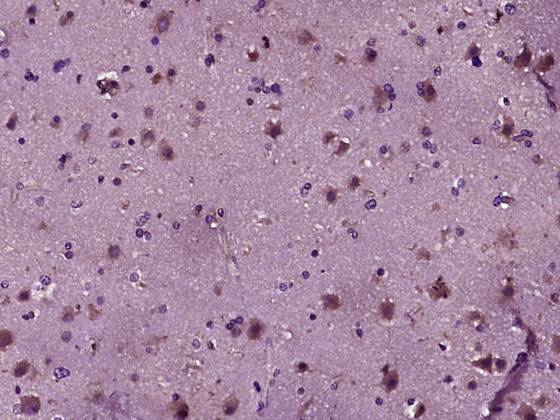 蛋白激酶A催化亚基抗体-bs-7479R