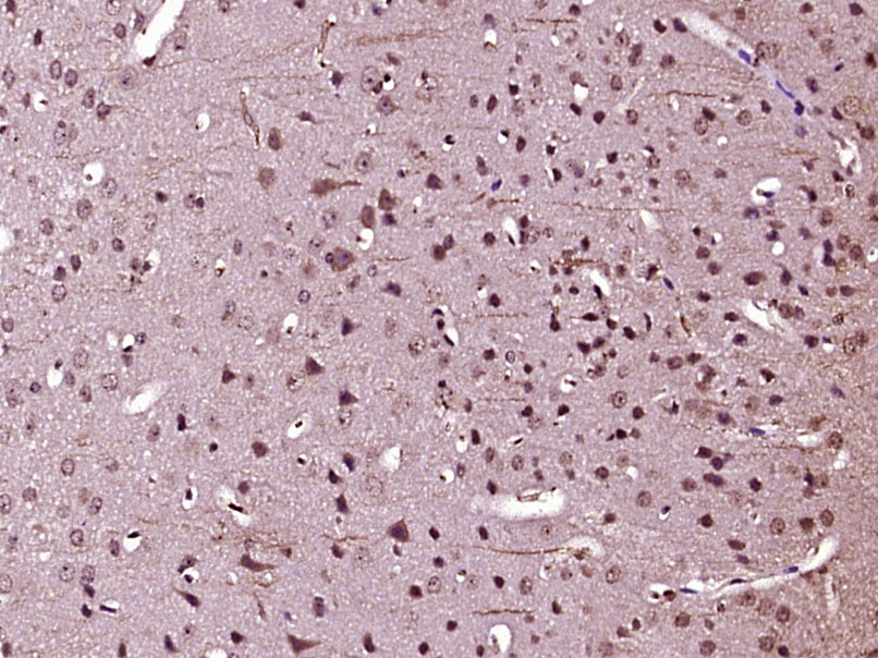 蛋白激酶A催化亚基抗体-bs-7479R