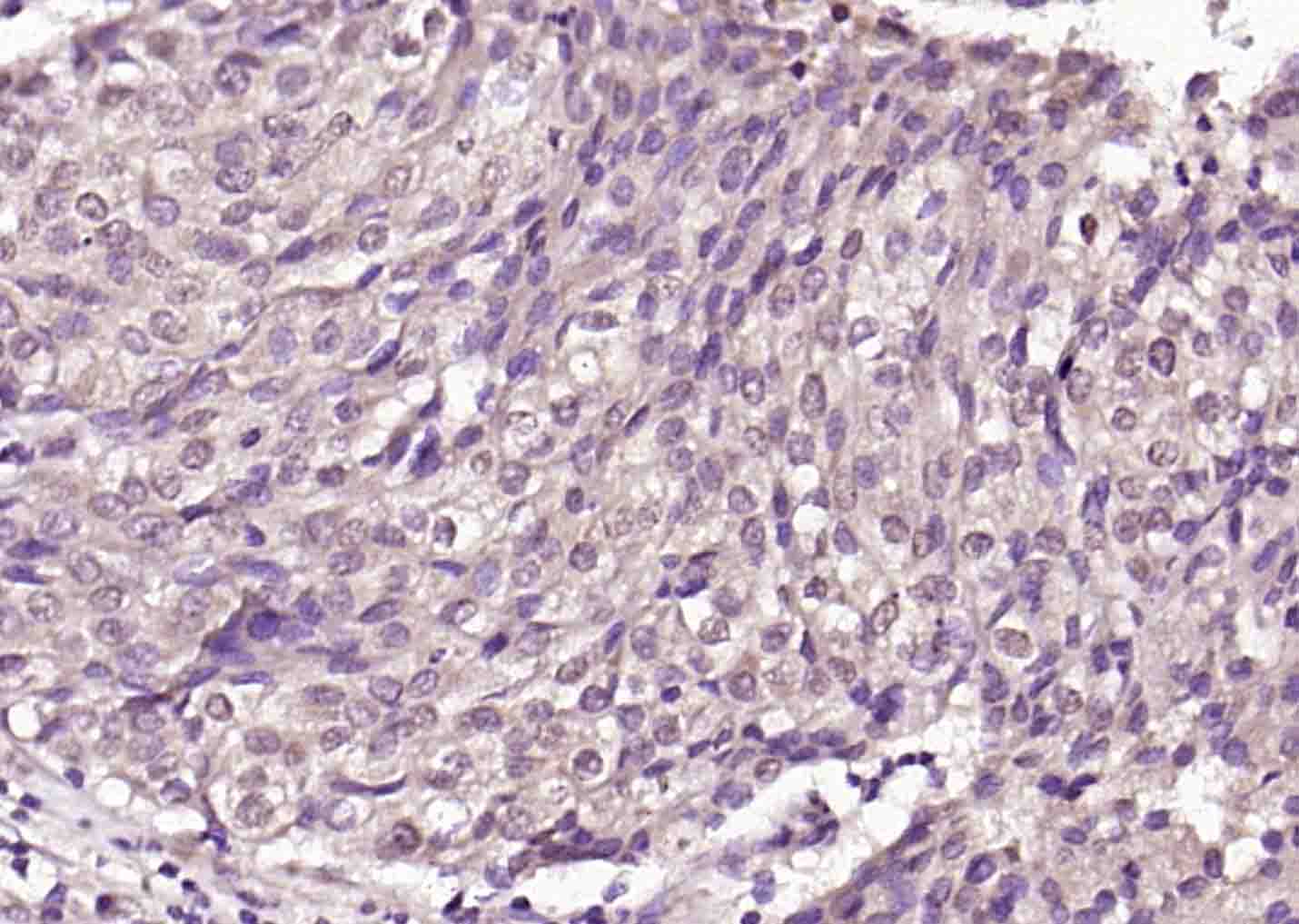 PRKACA Rabbit pAb (一抗) | Bioss