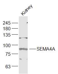 SEMA4A Rabbit pAb (一抗) | Bioss