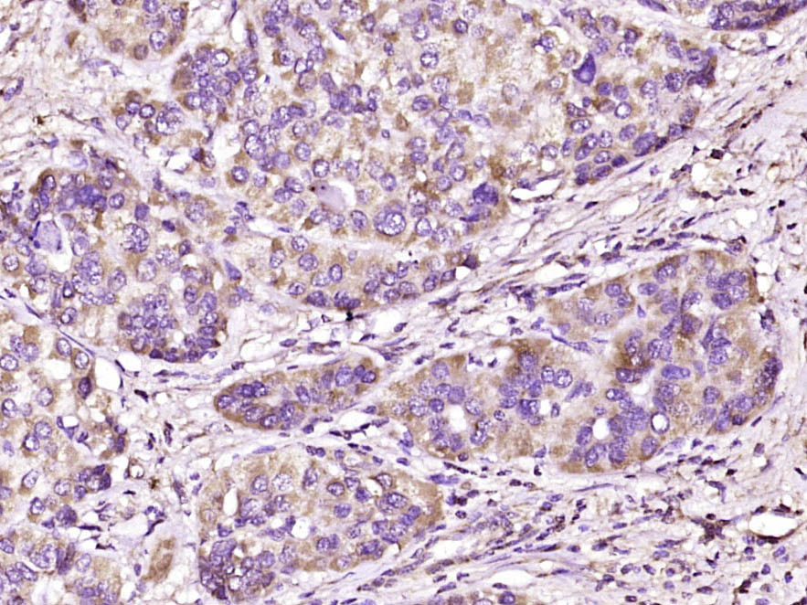 跨膜蛋白SEMA4A抗体-bs-7519R