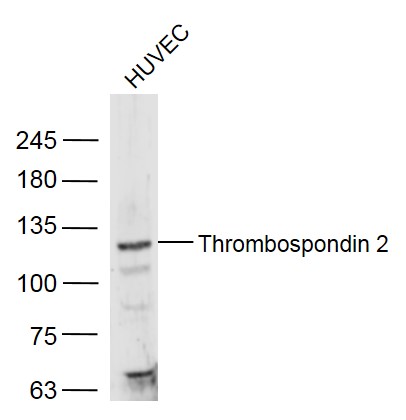 Thrombospondin 2 Rabbit pAb (一抗) | Bioss