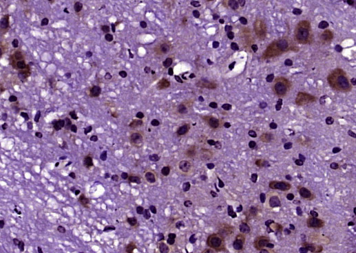 脱氧核糖核酸酶2抗体-bs-7652R