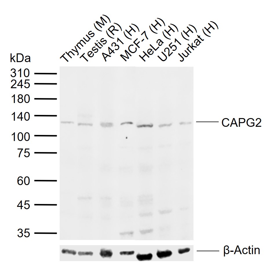 CAPG2 Rabbit pAb (一抗) | Bioss