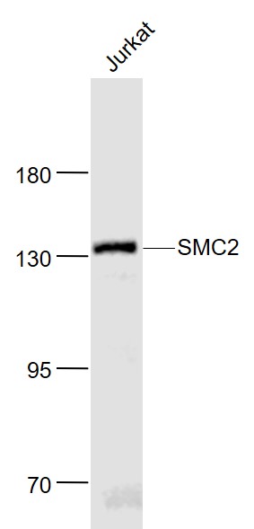 SMC2 Rabbit pAb (一抗) | Bioss