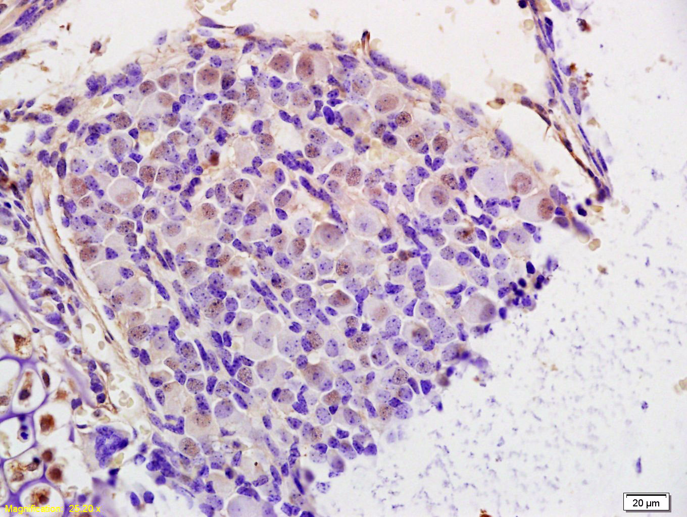 NUSAP1 Rabbit pAb (一抗) | Bioss