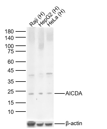 AICDA Rabbit pAb (一抗) | Bioss