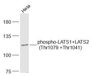 phospho-LATS1+LATS2 (Thr1079 +Thr1041) Rabbit pAb (一抗) | Bioss