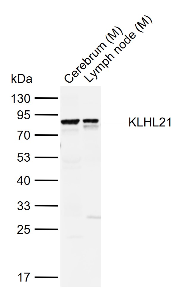 KLHL21 Rabbit pAb (一抗) | Bioss