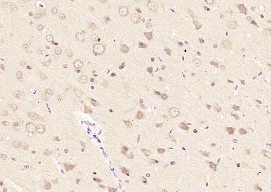 过氧化物酶-2抗体-bs-8300R