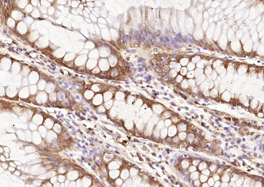过氧化物酶-2抗体-bs-8300R