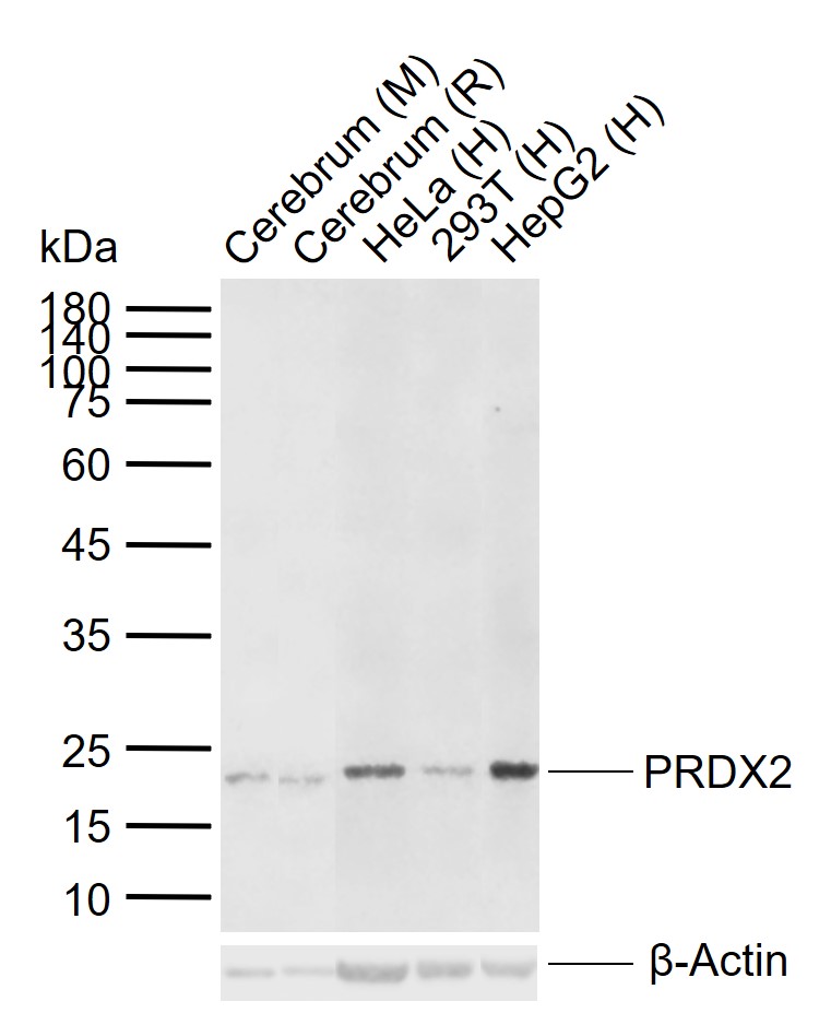 PRDX2 Rabbit pAb (一抗) - WB,IHC-P,IHC-F,IF | Bioss