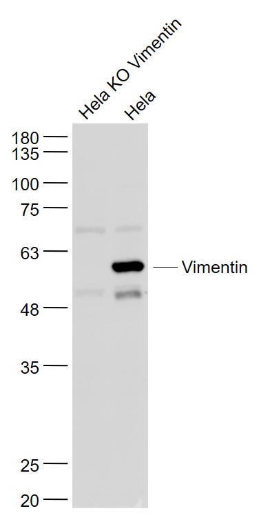 Vimentin Rabbit pAb (一抗) - WB,IHC-P,IHC-F,IF,Flow-Cyt,ICC/IF | Bioss