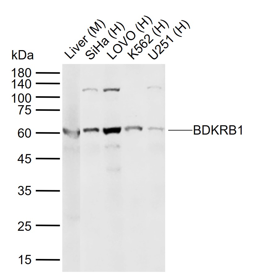 BDKRB1 Rabbit pAb (一抗) | Bioss
